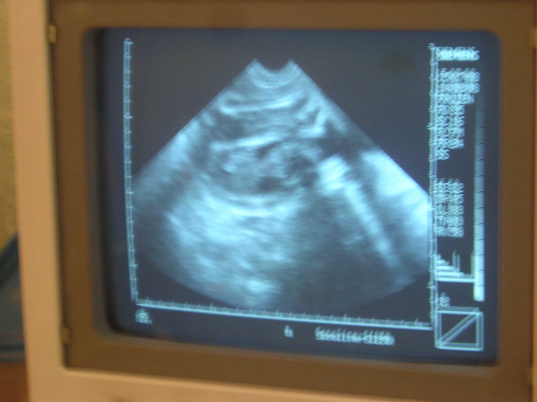 08  7 15  Baby US 3  P7150153